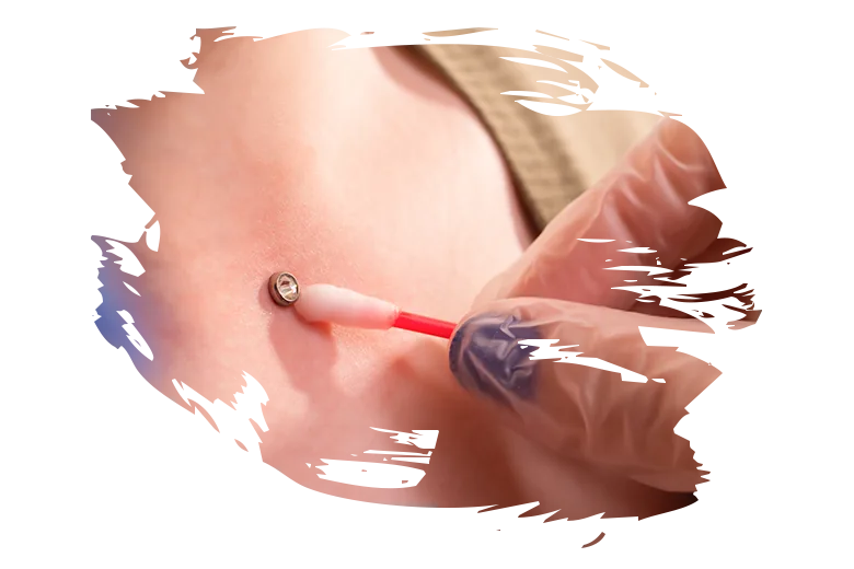 Microdermal