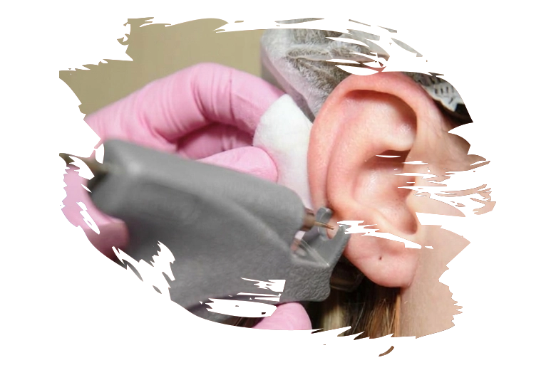 Microdermal